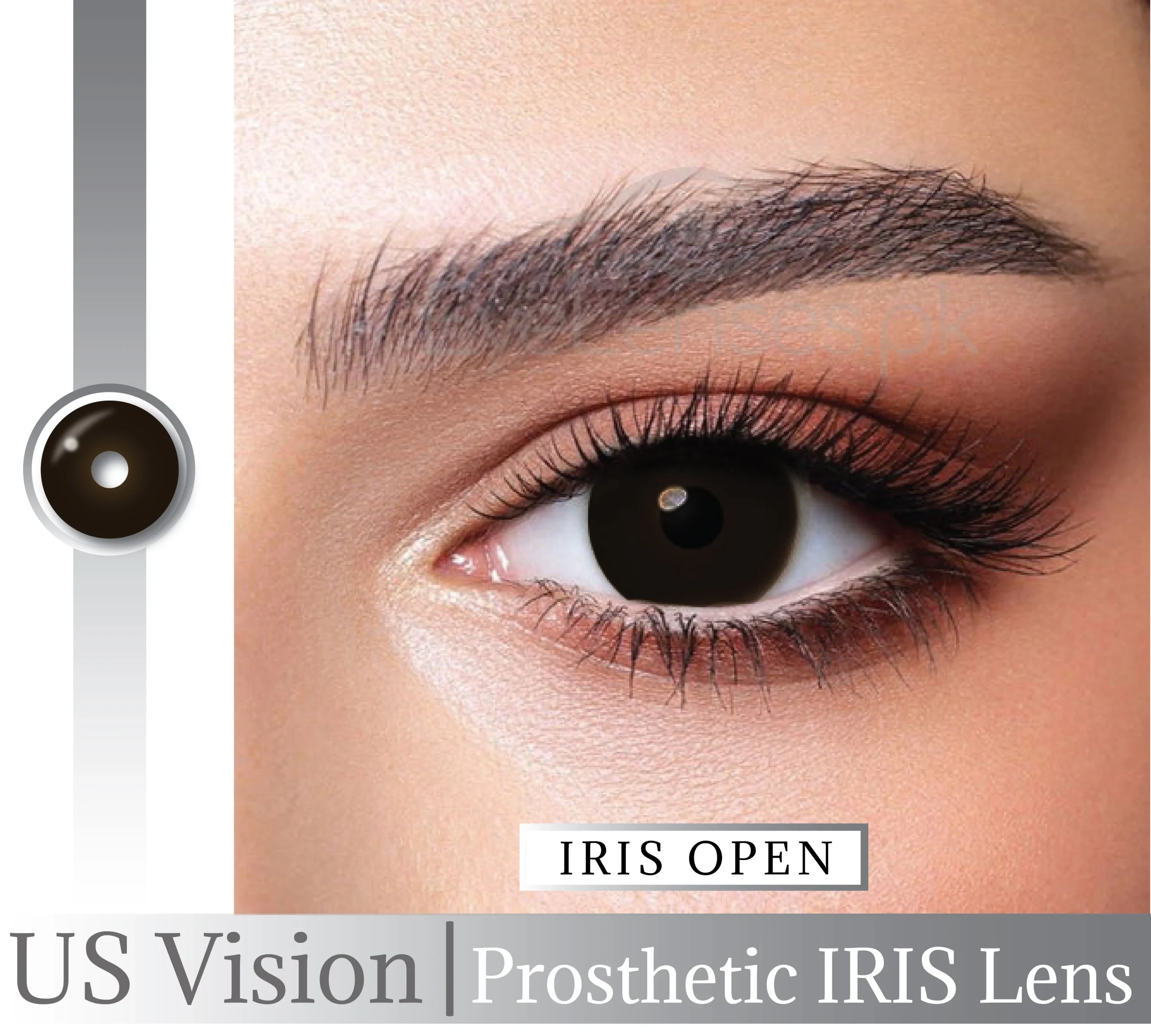 IRIS Open Lens Us Vision for Damage eye